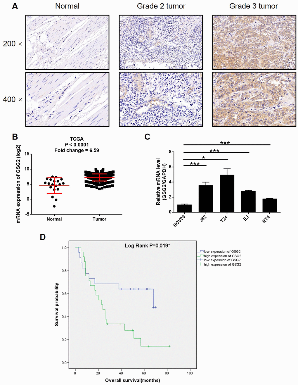 GSG2 was up-regulated in bladder cancer. (A) The expression of GSG2 in bladder cancer tissues and normal tissues was detected by IHC. (B) Data mining of TCGA database showed that expression of GSG2 is relatively higher in bladder cancer tissues compared with normal tissues. (C) Endogenous expression of GSG2 in human bladder epithelial cell line HCV29 and bladder cancer cell lines including RT4, EJ, T24 and J82 was detected by qPCR. (D) Kaplan-Meier survival analysis was performed to reveal the relationship between GSG2 expression and prognosis of bladder cancer patients. The figures are representative data from at least three independent experiments. The data were expressed as mean ± SD (n ≥ 3), *PPP