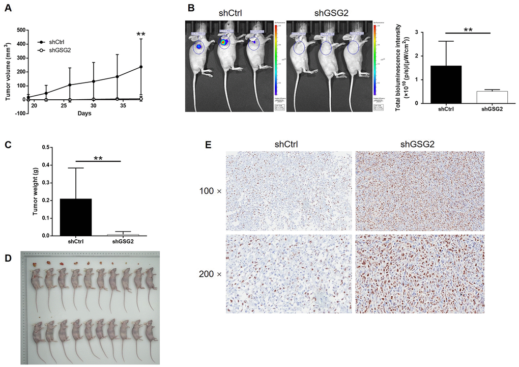 GSG2 knockdown inhibited tumor growth of bladder cancer in vivo. (A) The volume of tumors was measured and calculated throughout the culture of mice models. (B) The bioluminescent imaging of mice models was performed before the sacrifice of mice models. (C) The weight of tumors was measured after the removal of tumors from the mice models. (D) The photos of tumors removed from mice models were collected after the sacrifice of mice. (E) The expression of Ki-67 in the removed tumor tissues was detected by IHC. The figures are representative data from at least three independent experiments. The data were expressed as mean ± SD (n ≥ 3), *PPP