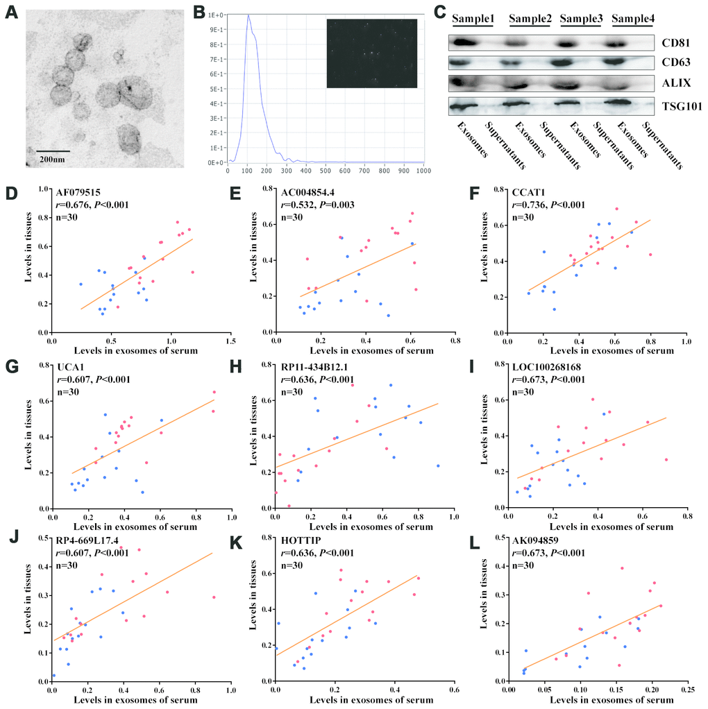 Detection of recurrence-associated lncRNAs in serum exosomes. (A) Electron microscopy images of exosomes. (B) Nanoparticle tracking analysis of the size distributions of exosomes. (C) Western blotting analysis of the markers of exosomes (CD81, CD63, ALIX and TSG101). (D–L) Correlation analyses between each lncRNA expression in tissues and in matched serum exosomes; Red and blue dots represent the lncRNA levels in recurrence and nonrecurrence CRC patients of the discovery cohort, respectively; [Spearman test].