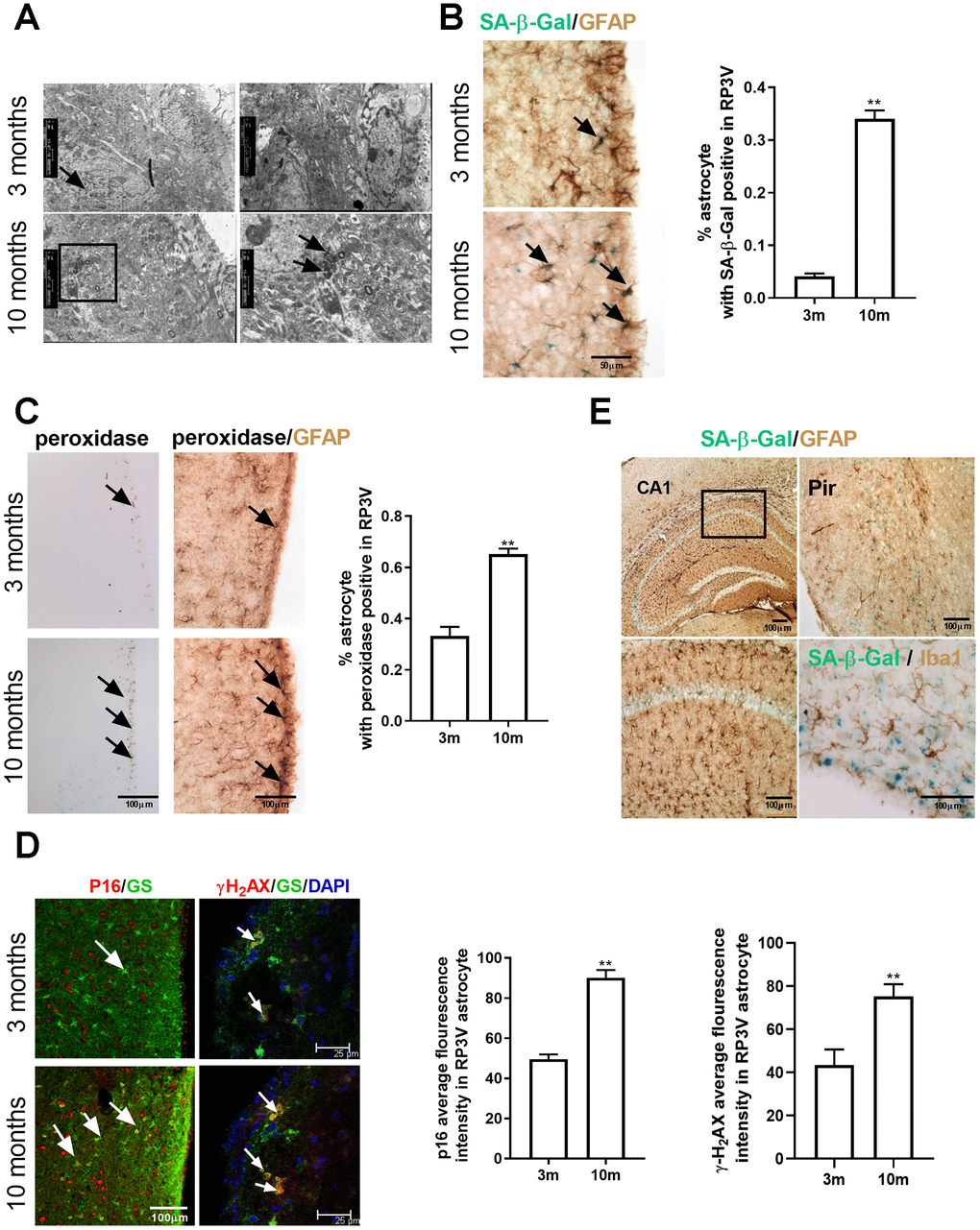 Astrocytes within the hypothalamic RP3V accumulates senescence-related markers with increasing age. (A) The lipofuscin deposition by transmission electron microscopy in hypothalamic astrocytes of female C57BL/6J mice at the age of 3 months and 10 months. Black arrows represent the lipofuscin deposition. (B) Dual-label immunohistochemistry of astrocytes by GFAP staining (brown) and by SA-β-Gal staining (blue) in 3-month-old mice (n=5) and 10-month-old mice (n=5), black arrows representing SA-β-Gal –positive astrocytes, scale bar=50μm. (C) Peroxidase staining (brown) in the astrocytes of RP3V (left), black arrows representing peroxidase. GFAP (black) and peroxidase (brown) double staining in astrocytes of RP3V in the hypothalamus of 3-month-old mice (n=5) and 10-month-old mice (n=5), black arrows representing peroxidase–positive astrocytes, scale bar =100μm. (D) Dual-label immunofluorescence showing astrocytes (green) with p16 (red) in young (n=5) and middle-aged mice (n=5), white arrows representing p16–positive astrocytes, scale bar=100μm (left). Dual-label immunofluorescence showing astrocytes (green) with γ-H2AX (red) in young (n=5) and middle-aged mice (n=5), white arrows representing γH2AX–positive astrocytes, scale bar=25μm (right). (E) Dual-label immunohistochemistry showing astrocytes (brown) with SA-β-Gal staining (blue) in 10-month-old mouse cortex (left picture) and hippocampal (top right picture). Dual-label immunohistochemistry showing microglia (brown) with SA-β-Gal staining (blue) in RP3V of 10-month-old mice (bottom right picture). Scale bar=100μm. The p-value was determined by Student’s t test,** p