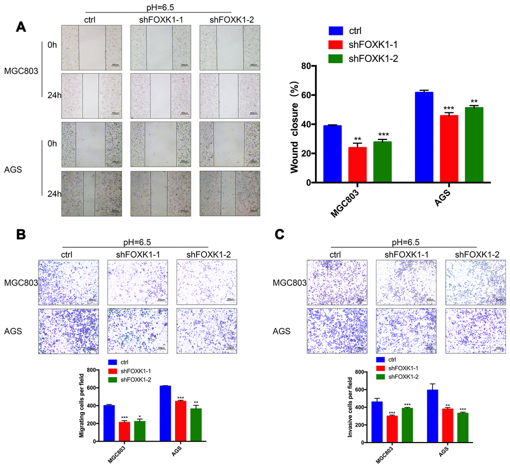 FOXK1 inhibition inhibits the invasion and metastasis of GC cells in an acidic microenvironment in vitro. (A) Wound healing assays were performed to detect changes in the migration of MGC803 and AGS cells at pH 6.5. The analysis of wound healing was performed using ImageJ software. Scale bar, 500 μm. (B) Pretreatment of MGC803 and AGS cells at pH 6.5. Transwell assays were performed to assess the migration capacity of GC cell lines. Scale bar, 500 μm. (C) Transwell assays were performed to assess the invasive ability of acidic MGC803 and AGS cells. Scale bar, 500 μm. The data are presented as the means ± S.D.s from three independent experiments. * P 