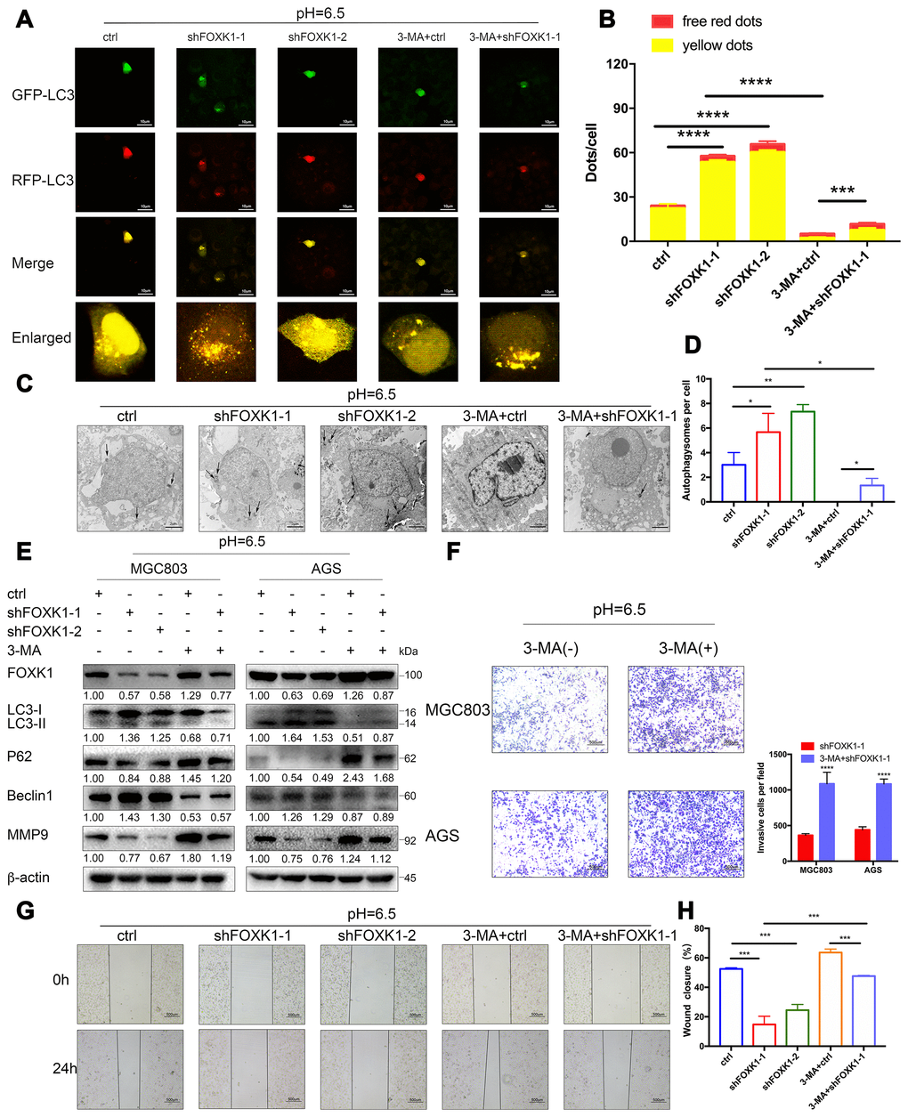 The silencing of FOXK1 induces autophagy to inhibit the migration and invasion of acidic GC cells. (A–H) Acidic MGC803 and AGS cells were infected with an empty lentivirus control (LV-ctrl) or with LV shFOXK1-1 or shFOXK1-2 and subsequently incubated for 24 h prior to pretreatment with 2 mM 3-MA or PBS (control). (A, B) Laser confocal microscopy analysis and quantification of transfected MGC803 cells with plasmid constructs containing LC3, which was fused with tandem mRFP-GFP tags. Scale bar, 10 μm. (C, D) The number of autophagosomes was observed and quantified under a transmission electron microscope. Scale bar, 2 μm. (E) Western blotting analysis of the levels of FOXK1, LC3-I, LC3-II, P62, Beclin1 and MMP9; β-actin was used as a loading control. (F) Matrigel cell invasion assays of MGC803 and AGS cells were performed, and the invading cells were quantified. (G, H) Scratch test evaluation of MGC803 cells. The wound healing area was analyzed using ImageJ software. Scale bar, 500 μm. The data are presented as the means ± S.D.s from three independent experiments. * P 