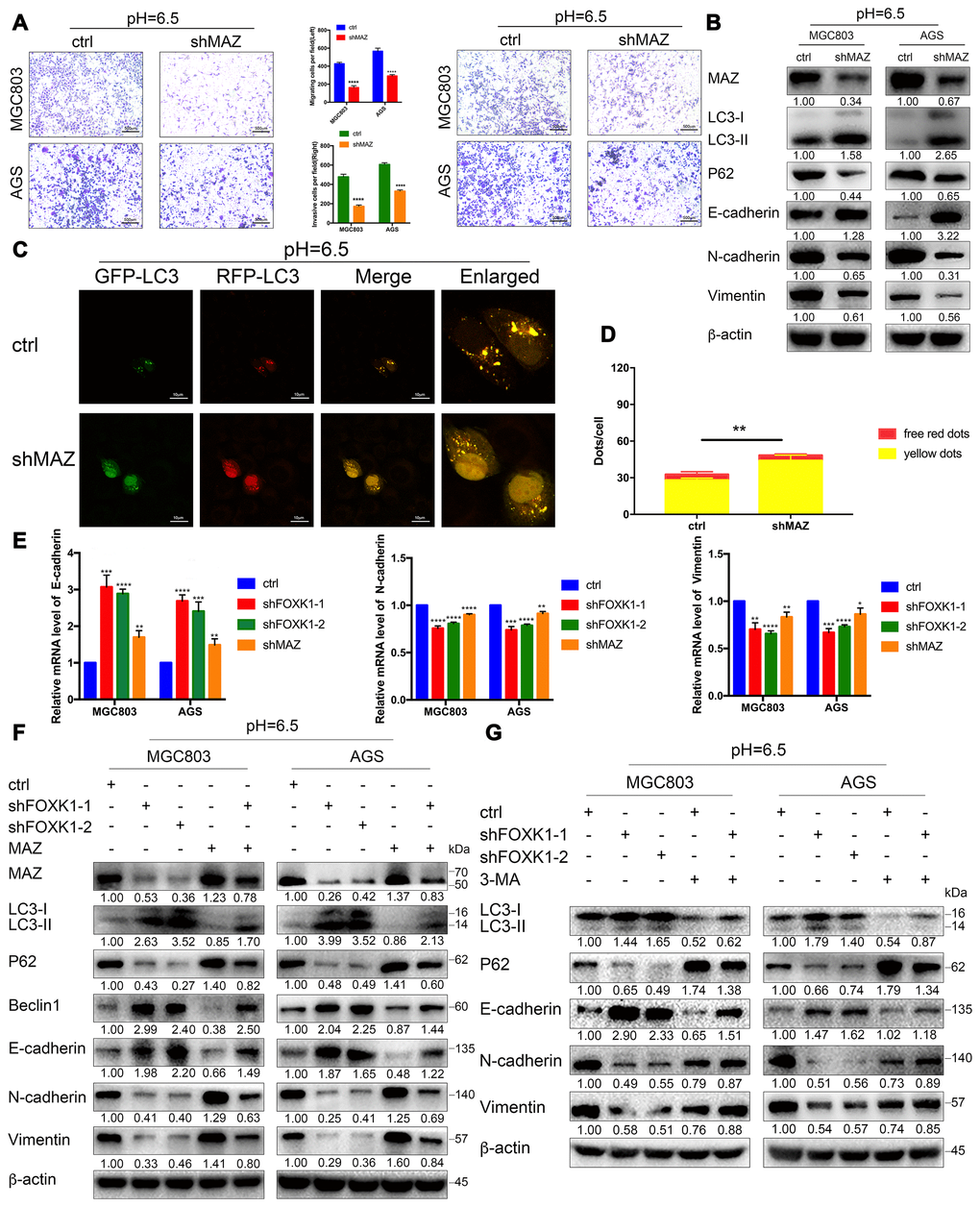 Acidic conditions stimulate shFOXK1 to induce autophagy and inhibit EMT through the downregulation of MAZ. (A) Transwell assays were performed to assess the migration and invasion of MGC803 and AGS cells following MAZ knockdown at pH 6.5. Scale bar, 500 μm. (B) Western blotting was performed to detect the protein expression of MAZ, autophagy-related proteins and EMT-related proteins in GC cells treated with ctrl or shMAZ in an acidic microenvironment. (C) Immunofluorescence staining was used to detect the autophagic flux in acidic MGC803 cells treated with ctrl or shMAZ, and the quantified results are shown in (D). Scale bar, 10 μm. (E) qRT-PCR analysis of EMT-related mRNA expression in MGC803 and AGS cells expressing ctrl, shFOXK1-1, shFOXK1-2 and shMAZ. (F) Western blotting was performed to detect the expression of MAZ, autophagy-related proteins and EMT-related proteins in ctrl (or shFOXK1-1)-transfected acidic GC cells cotransfected with MAZ plasmids. (G) MGC803 and AGS cells cultured at pH 6.5 were pretreated with 2 mM 3-MA or PBS (control) and then incubated with LV-ctrl, shFOXK1-1 and shFOXK1-2 for 24 h. The expression levels of autophagy-related proteins and EMT-related proteins were verified by Western blotting and quantified. The data are presented as the means ± S.D.s from three independent experiments. * P 