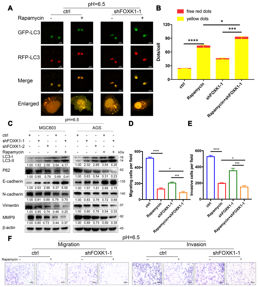 Dual inhibition of mTOR and FOXK1 enhances autophagy and leads to the synergistic transfer of acidic GC cells. (A–G) Acidic MGC803 cells were treated with DMSO or rapamycin (100 nM) or infected with ctrl, shFOXK1-1, shFOXK1-2 or a combination of these for 24 h. (A) The red-only and yellow puncta of MGC803 cells transfected with mRFP-GFP-LC3 were observed under laser confocal conditions, and the quantitative results are shown in (B). Scale bar, 10 μm. (C) Western blotting was performed to assess the expression intensity of LC3-I, LC3-II, P62, E-cadherin, N-cadherin, Vimentin and MMP9. (D–F) The migration and invasive capabilities of MGC803 cells were examined. The invading cells are quantified in (D, E). The data are presented as the means ± S.D.s from three independent experiments. * P 