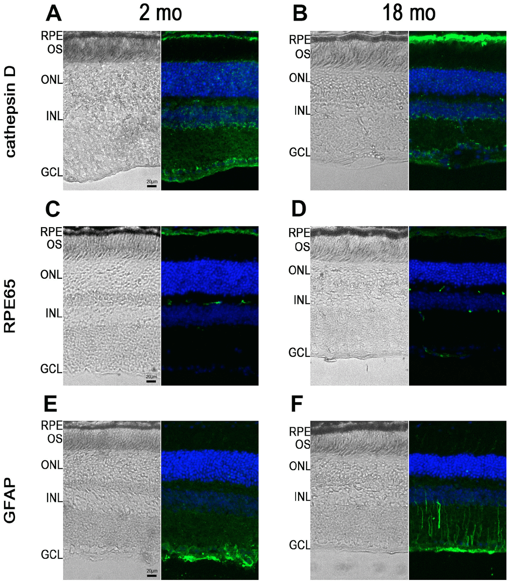 RPE65, cathepsin D and GFAP immunostaining in Abca4-/- Rdh8-/- mice of different ages. Pictures showing retinal cryosections of 2-month-old (A, C, E) and 18-month-old (B, D, F) mice captured in bright field (left pictures) or after immunostaining for cathepsin D (A, B), RPE65 (C, D) and GFAP (E, F). OS: outer segment; ONL: outer nuclear layer; INL: inner nuclear layer; GCL: ganglion cell layer.
