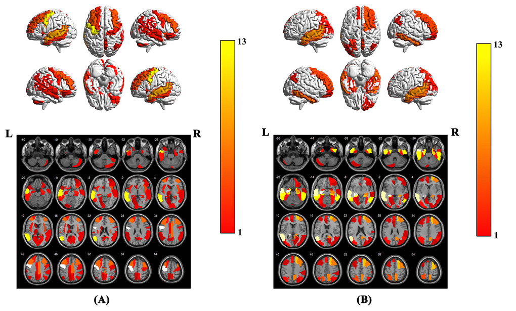 Brain region weight map based on AAL116 template, (A) represents the brain regions that have the greatest impact on the classification between AD patients and NCs when using the model parameters of this experiment on our in-house dataset, (B) represents the brain regions that have the greatest impact on the classification between AD patients and NCs. The weight value of each brain region is based on the average of the weight values in the brain region. The color bar represents the average weight value in each brain region, the larger the weight value of the model, the warmer the color in the graph.