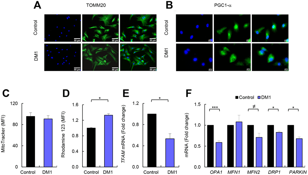 DM1-derived fibroblasts have no changes in mitochondria biogenesis. (A, B) Representative images of immunofluorescence of TOMM20, and PGC1-α in DM1 and control fibroblasts (n=3). (C) Medium fluorescence intensity of MitoTracker Red FM in control (n=3) and DM1 cells (n=5) and (D) of Rhodamine 123 in DM1 and control fibroblasts (n=3). (E) mRNA levels of TFAM transcription factor (n=3). (F) mRNA levels of OPA1, MFN1, MFN2, DRP1 and PARKIN in DM1 and control fibroblasts (n≥2).
