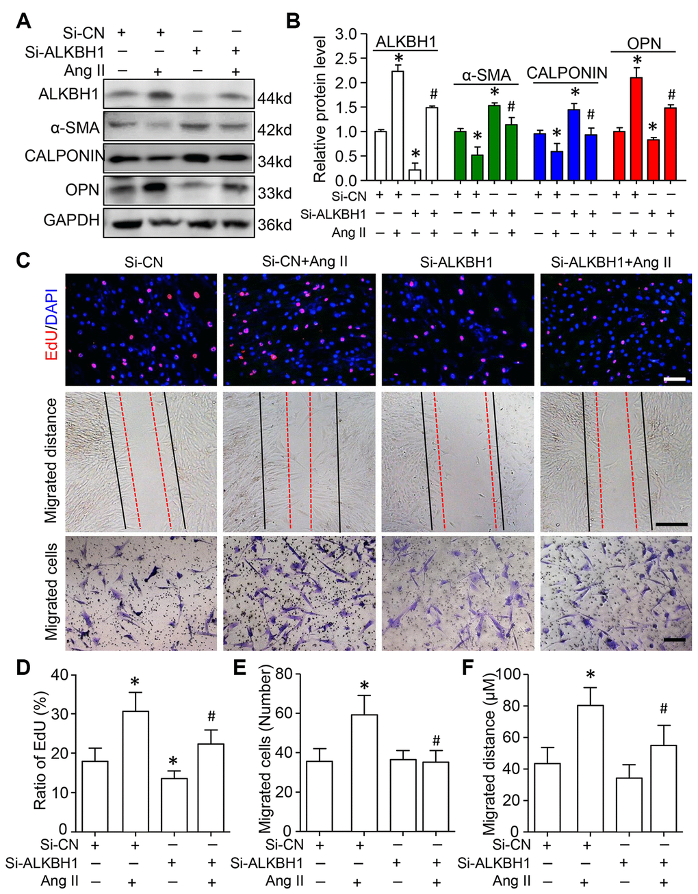 Knockdown of ALKBH1 suppresses Ang II-induced VSMC phenotype transformation, proliferation and migration. (A, B) Representative western blot and quantification of levels of ALKBH1, alpha-smooth muscle actin (α-SMA), CALPONIN, and osteopontin (OPN) in si-RNA-ALKBH1 (Si-ALKBH1)– or si-RNA Control (Si-CN)–transfected HASMCs with Ang II treatment or not. (C–F) Representative images of EdU staining, HASMC migration distance and number with Si-ALKBH1 and/or Ang II treatment and quantification. Scale bar: 100 μm. *P #P A and B, n= 5/group for C–F). One-way ANOVA followed by Bonferroni’s multiple comparison test was used for statistical analysis in B and D.