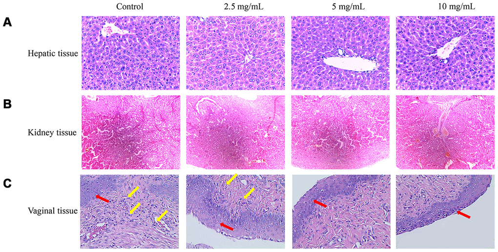 Therapeutic effects of flavonoids in A. conyzoides on bacterial vaginitis in mice. (A, B) HE staining showed that various doses of flavonoids in A. conyzoides did not induce obvious histomorphologic changes in liver and kidney tissues of mice. (C) In the control group, the squamous cells in the basal layer of vagina tissue were damaged and a large number of inflammatory cells were infiltrated in vagina tissue, indicating that the bacterial vaginitis model in mice was successfully established. After treatment with low concentration of flavonoids in A. conyzoides (2.5 mg/mL), fewer inflammatory cells were observed. Furthermore, after treatment with middle and high concentrations of flavonoids in A. conyzoides (5 mg/mL and 10 mg/mL), no obvious inflammatory cell infiltration in vagina tissue was observed and the squamous cells in the basal layer were arranged regularly and smoothly, indicating that inflammation in vagina tissue was remarkably improved. Red arrows point to squamous cells and yellow arrows point to inflammatory cells.