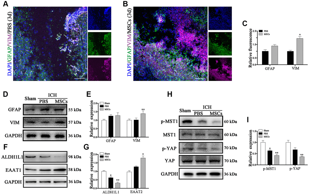 The astroglial mesenchymal phenotype switching of astrocytes in ICH. (A) Immunofluorescence staining for VIM (purple) and GFAP (green) in ICH mouse brain at 3d post-PBS transplantation. Bar = 100μm. GFAP and VIM were expressed in reactive astrocytes around the lesion area. (B) Immunofluorescence staining for VIM (purple) and GFAP (green) in the ICH mouse brain at 3d post-BM-MSCs transplantation. Bar = 100μm. After the transplantation of BM-MSCs, VIM was strongly expressed, whereas GFAP remained at the same level. (C) The results of relative fluorescence intensity of GFAP and VIM, plotting into a histogram of five randomly fields. (D–I) Western blotting analysis of GFAP, VIM, ALDH1L1, EAAT1, p-MST1, MST1, p-YAP and YAP expression in the ICH mouse brain of Sham, PBS, and BM-MSCs treatment at 3d. Expressions were normalized against the internal reference GAPDH. The fold change values were calculated by normalizing to the sham group. The results were plotted as mean ± SD (n = 6). *p 