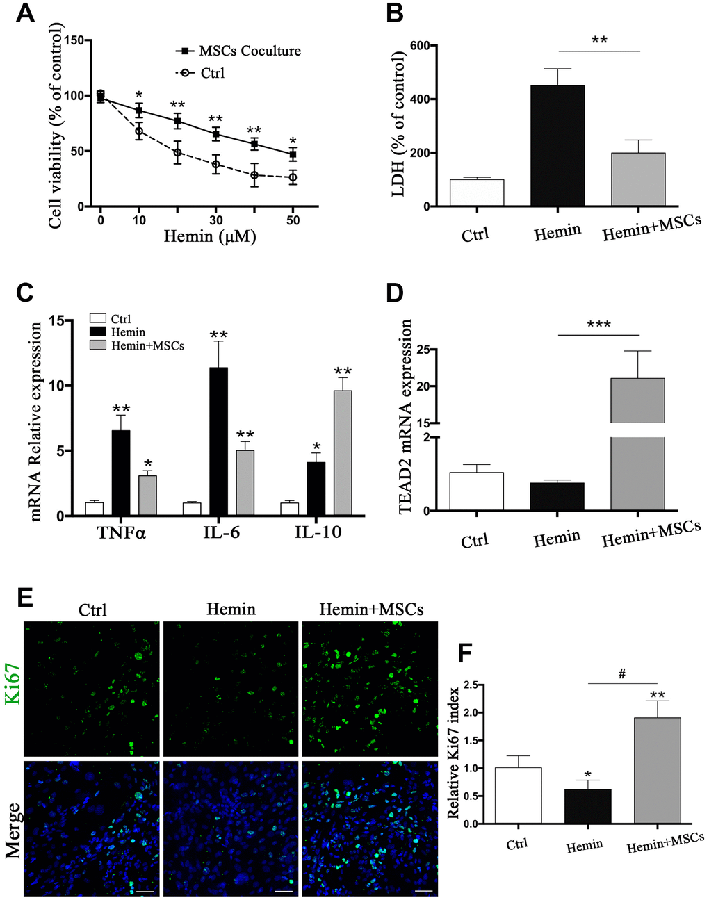BM-MSCs coculture protected astrocytes from neurotoxicity induced by hemin. (A) Astrocytes were exposed to 0, 5, 10, 20, 30, 40, 50μM hemin for 24 h with or without BM-MSCs coculture, then the cell viability was evaluated by CCK-8. (B) Astrocytes were exposed to 30μM hemin with or without BM-MSCs for 24 h, and the cell death was evaluated by LDH releasing assay; (C) mRNA expression of TNFα, IL-6, and IL-10 was checked. (D) mRNA expression of TEAD2 was checked. (E, F) Ki67 staining (green) was applied to mark cell proliferation, bar = 25μm. The results plotted as mean ± SD (n = 4), and the relative expression of the mRNA and results of proliferation rate were normalized to control and plotted into a histogram. *pp p p 
