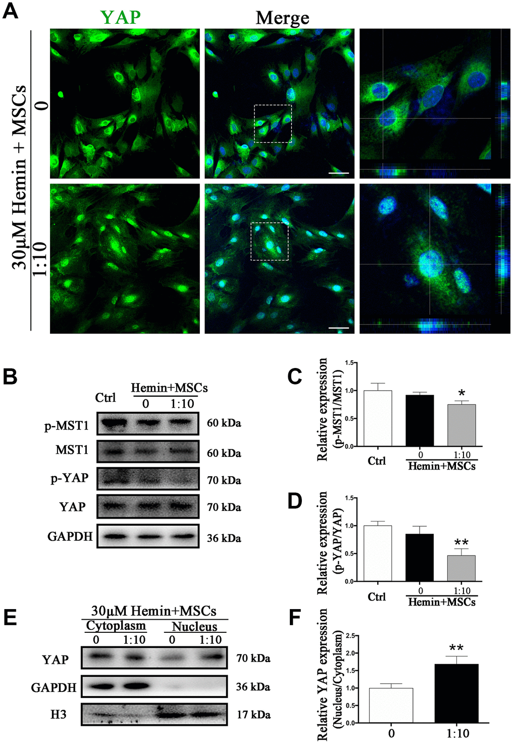 BM-MSCs coculture promoted YAP nuclear translocation in astrocytes. (A) Immunofluorescence staining of astrocytes with YAP (green). The cell nuclei were counterstained with DAPI (blue). BM-MSCs coculture treatment triggered YAP nuclear translocation in astrocytes exposure to 30 μM hemin. Bar = 25 μm. (B–D) Western blotting analysis of p-MST1, MST1, p-YAP and YAP expression in astrocytes exposure to 30 μM hemin, with or without BM-MSCs coculture for 24 h. (E, F) Western blotting analysis of cytoplasmic and nucleus extraction samples from astrocytes, with or without BM-MSCs coculture, with YAP antibody. GAPDH and H3 were used as a loading control for cytoplasmic and nucleus protein, respectively. The histogram showing the results of densitometric analysis of nucleus/cytoplasmic YAP expression in astrocytes cocultured with BM-MSCs or not. The results were normalized to control and plotted as mean ± SD (n = 4). *p p 