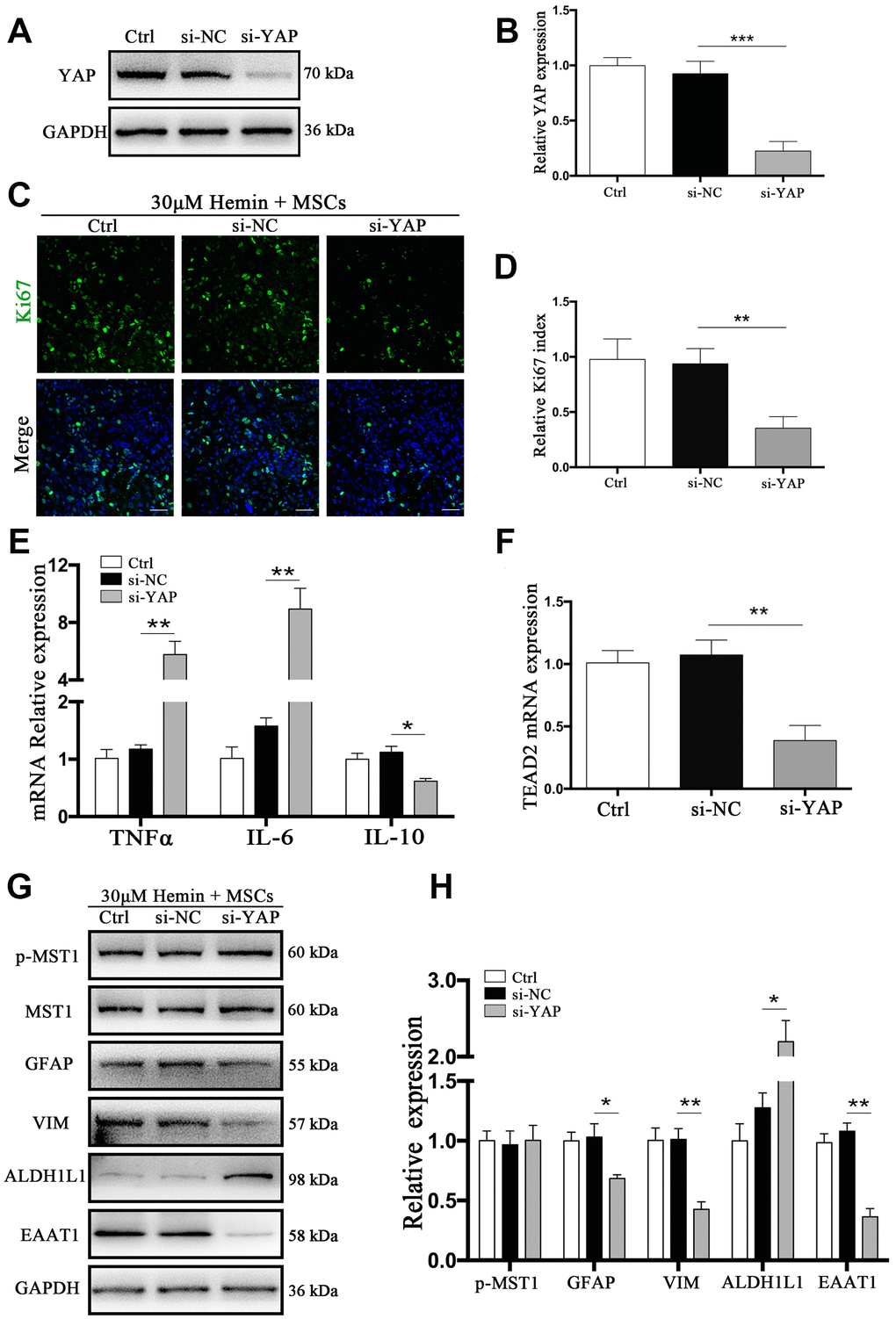 si-YAP counteracted BM-MSCs coculture induced cell proliferation and GFAP/VIM switching. (A) Western blotting analysis of YAP expression in ctrl, si-NC, and si-Nrf2 transfected astrocytes. (B) The results of densitometric analysis of the bands were plotted as mean ± SD (n = 4). Over 83% of YAP expression was suppressed by si-YAP. ***p C) Representative pictures of Ki67 immunofluorescence staining. Ki67-positive cells were labeled in green. Bar = 50μm. (D) The results of the proliferation rate and densitometric analysis of the bands were plotted into a histogram of five randomly fields. (E). mRNA expression of TNFα, IL-6, and IL-10 was checked. (F) mRNA expression of TEAD2 was checked. (G, H) Western blotting analysis of p-MST1, MST1, GFAP, VIM, ALDH1L1, and EAAT1 protein expression was examined. The relative expression was normalized to control. The results of densitometric analysis of the bands were plotted as mean ± SD (n = 4). *p p 