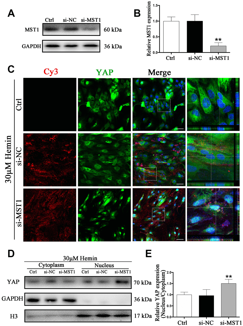 Knockdown of MST1 triggered YAP nuclear translocation. (A) Western blotting analysis of MST1 expression in ctrl, si-NC, and si-Nrf2 transfected astrocytes. (B) The results of densitometric analysis of the bands were plotted as mean ± SD (n = 4). Over 80% of MST1 expression was suppressed by si-MST1. **p C) Immunofluorescence staining of ctrl, si-NC, si-MST1 treated astrocytes with anti-YAP (green). The siRNA was labeled with fluorophore Cy3 (red) to show the transfected cells. The cell nuclei were counterstained with DAPI (blue). Bar = 50μm. (D, E) Western blotting analysis of cytoplasmic and nucleus extraction samples from control, si-NC, si-MST1 transfected astrocytes with anti-YAP. GAPDH and H3 were used as a loading control for cytoplasmic and nucleus protein, respectively. The histogram showing the results of densitometric analysis of nucleus/cytoplasmic YAP expression in ctrl, si-NC, si-MST1 transfected astrocytes. The results were normalized to control plotted as mean ± SD (n = 4). Si-MST1 significantly increased YAP nuclear expression. *p 