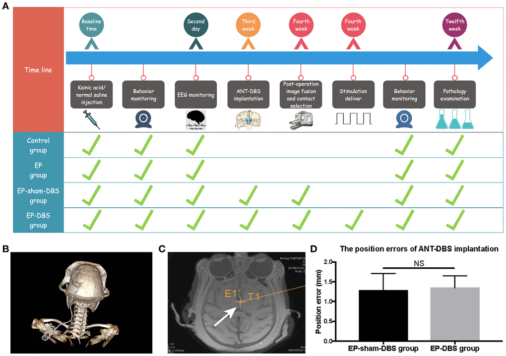 Experimental design and the lead location. (A) Twenty-four monkeys were randomly assigned to the four treatment groups, which differed with respect to manipulations. The time from the beginning of the manipulation is shown in the first line, and the green ticks indicate manipulation in each group. (B) 3D reconstruction of postoperative CT showed that the DBS lead was implanted through the frontoparietal skull and extended to the back. (C) The lead was accurately placed in the left ANT based on the merged pre-operative MR and post-operative CT (white arrow). The cross indicates the surgical planning target. (D) The position errors of ANT-DBS implantation between the EP-sham-DBS and EP-DBS groups were similar and ideal (n=6 in each group). NS, P> 0.05. Data were presented as mean ± SD.