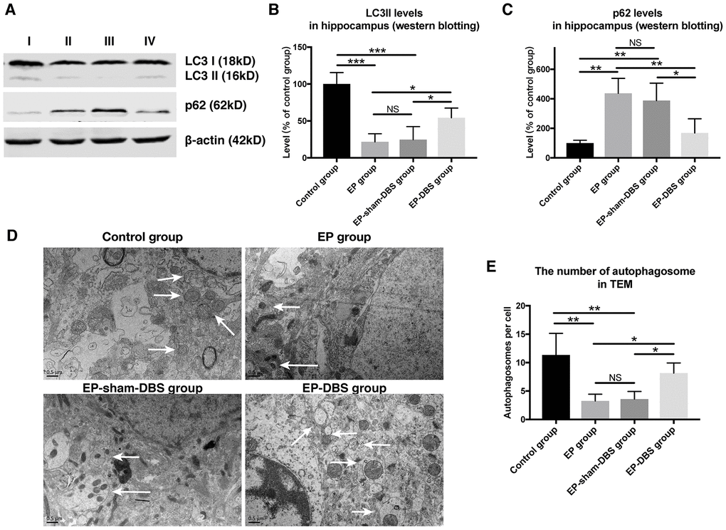 ANT-DBS activated autophagy in the hippocampus of epileptic monkeys. (A) Analysis of LC3II and p62 by western blotting. (B) Levels of LC3II were decreased in EP and EP-sham-DBS groups. ANT-DBS normalized LC3II level in the EP-DBS group. (n=3 in each group) (C) In the EP and EP-sham-DBS groups, p62 levels were increased, and decreased by ANT-DBS. (n=3 in each group) (D) Autophagosome observed by TEM. The left column shows the morphology of the autophagosome by TEM. In the other columns, the autophagosomes (white arrow) are shown around the nucleus. (E) The number of autophagosomes was counted in each view. A reduced number of autophagosomes were observed in the EP and EP-sham-DBS groups compared with the control group, which was increased by ANT-DBS. (n=3 in each group; in each monkey, twenty cells were randomly selected, and the average number of autophagosome for each monkey was recorded) *P P P P > 0.05. Data were presented as mean ± SD. I, control group; II, EP group; III, EP-sham-DBS group; IV, EP-DBS group.