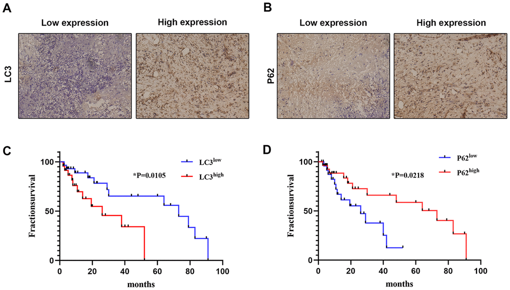 Correlation between autophagy-related marker expression and OS prognosis. The expression of LC3 (A) and P62 (B) was detected by IHC in clinical OS samples (×200). The correlation between OS survival rate and LC3 (C) and P62 (D) expression was analyzed using expression data from clinical OS specimens (Kaplan–Meier method); p values were obtained by log-rank multiple comparison tests.