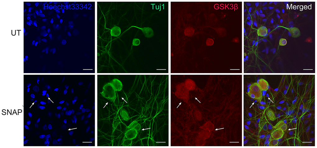 GSK-3β is predominantly expressed in TGNs. Cultured primary cells were treated with 1.0 mM SNAP for 2 h, and then cultured in NB medium without SNAP for an additional 24 h. After fixing with 4% paraformaldehyde, double immunofluorescent staining was performed using primary antibodies against GSK-3β (red) and Tuj1 (green), followed by counterstaining with Heochst33342 (blue) for nuclei. Scale bar = 20 μm. Arrows indicate representative Tuj1-negative cells.