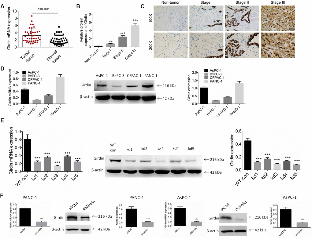 Expression of Girdin in pancreatic cancer tissues and cell lines. (A) The mRNA expression of Girdin in pancreatic cancer tissues and adjacent normal tissues was identified by RT-PCR analysis (n=41). (B, C) The protein expression of Girdin in pancreatic cancer tissues and adjacent normal tissues was examined by IHC analysis. (D) Girdin expression in pancreatic cancer cell lines (AsPC-1, BxPC-3, CFPAC-1 and PANC-1) was identified by western blot analysis and RT-PCR. (E) Girdin expression was knockdown by 5 shRNAs and Girdin expression was identified by western blot analysis. (F) AsPC-1 and PANC-1 cells were transfected with shGirdin plasmid, the transfection efficiency was examined by RT-PCR and western blot analysis. Data was shown as mean ± SD. ***P