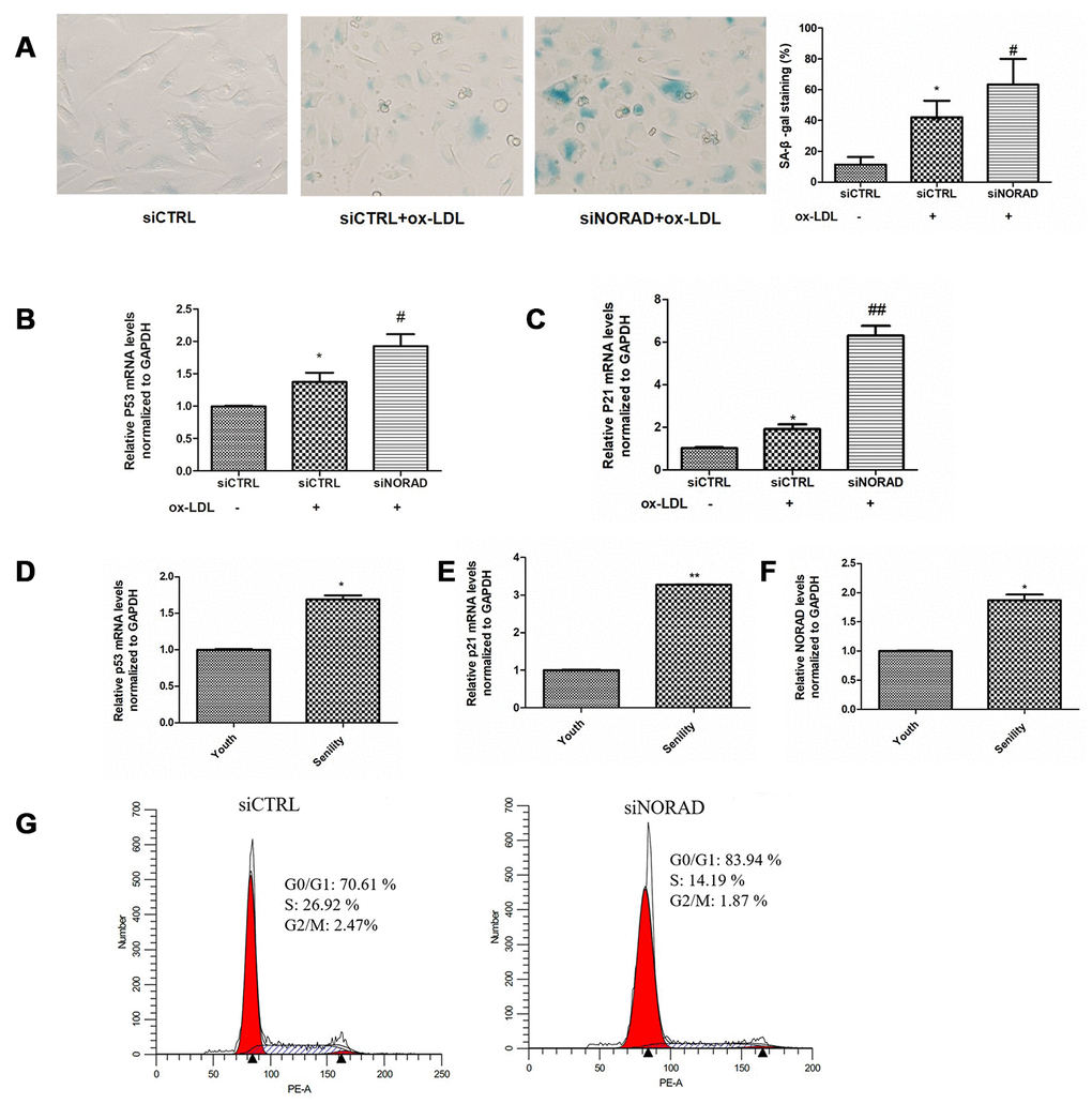 NORAD-knockdown is results in the cell cycle arrest in G0/G1 phase and aggravates ox-LDL-induced senescence of HUVECs. HUVECs were transfected with siNORAD or scrambled siCTRL. After transfection for 24 h, the cells were treated with 60 μg/mL ox-LDL for 24 h. (A) HUVECs were stained to determine SA-β-gal. NORAD-knockdown increased the number of positive-stained cells after they were treated with ox-LDL. Results were representative of three separate experiments. (B) mRNA expression of p53 in ox-LDL-treated HUVECs through RT-qPCR (n = 3, *P #P C) mRNA expression of p21 in ox-LDL-treated HUVECs through RT-qPCR (n = 3, *P ##P D) mRNA expression of p53 in young and senile HUVECs through RT-qPCR (n = 3, *P E) mRNA expression of p21 in young and senile HUVECs through RT-qPCR (n = 3, ##P F) NORAD levels in young and senile HUVECs through qRT-PCR (n = 3, *P G) NORAD silencing induced ox-LDL-treated cell cycle arrest at G0/G1 phase. Flow cytometry was used to detect the cell cycle distribution of ox-LDL-treated HUVECs.