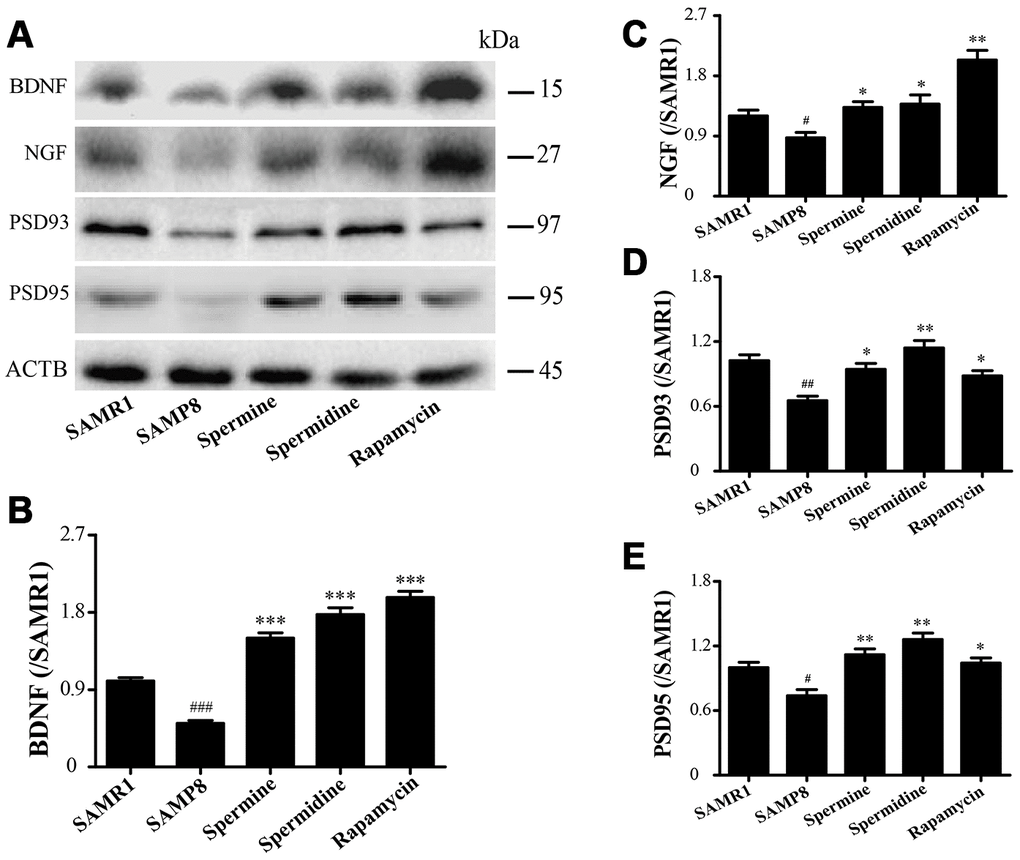 The effect of spermidine and spermine on neurodegeneration in SAMP8. (A) Western blot of NGF, PSD93, PSD95 and BDNF. (B) The expression of BDNF in the brain. (C) The expression of NGF in the brain. (D) The expression of PSD93 in the brain. (E) The expression of PSD95 in the brain. (Data represent mean ± SEM (n = 3 per group). #P ##P ###P P P P 