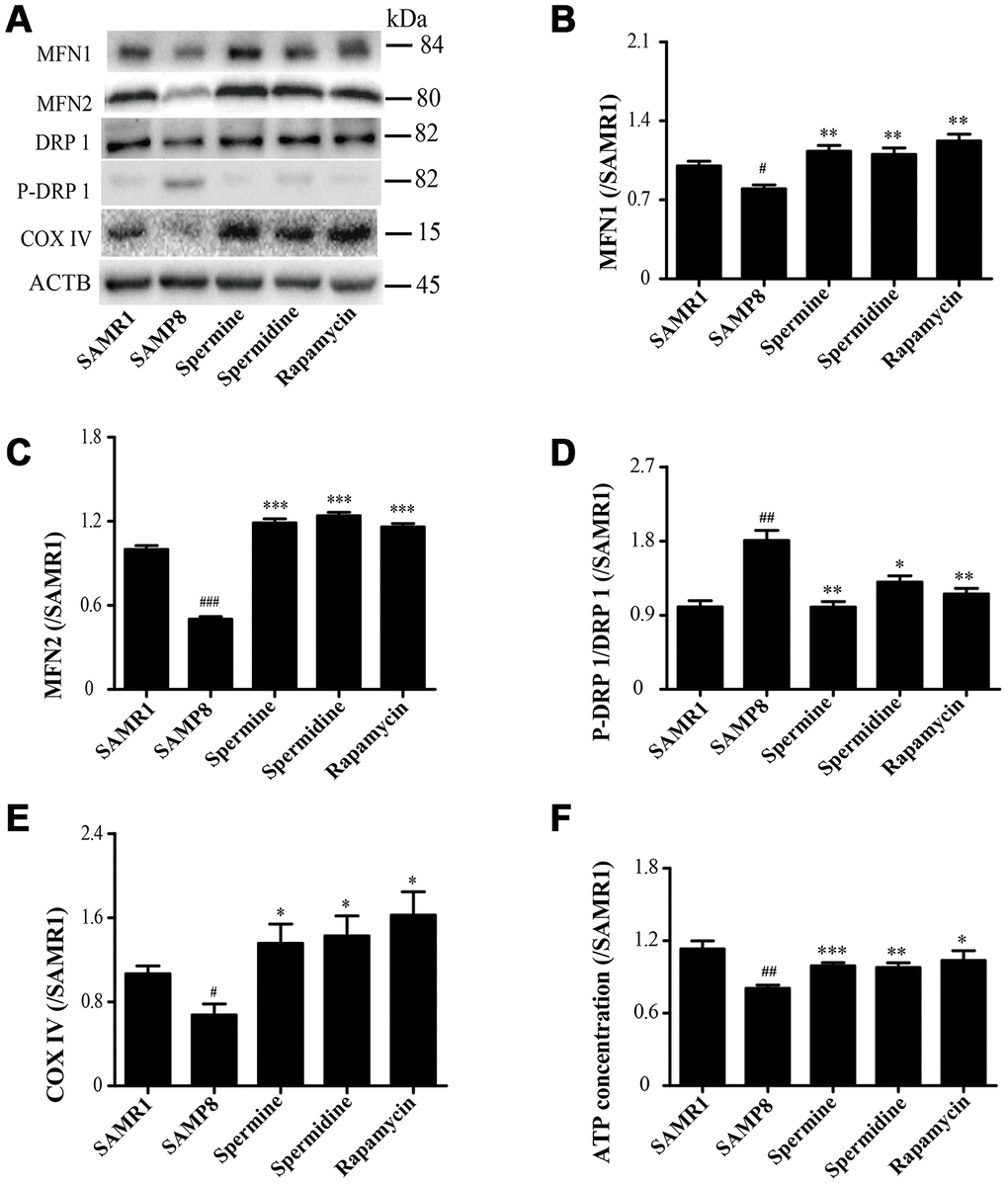 Spermidine and spermine redress mitochondrial dysfunction in SAMP8. (A) The western blot of mitochondrial protein. (B) The expression of MFN1 in the brain. (C) The expression of MFN2 in the brain. (D) The expression of P-DRP1 in the brain. (E) The expression of COX IV in the brain. (F) The concentration of ATP in the brain. Data represent mean ± SEM (n = 3 per group). #P ##P ###P P P P 