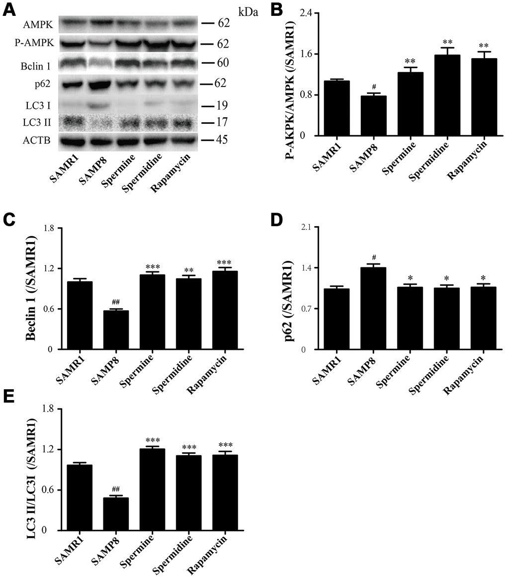 Spermidine and spermine phosphorylate AMPK and inducing autophagy in SAMP8. (A) The western blot of autophagy protein. (B) The expression of P-AMPK in the brain. (C) The expression of Beclin in the brain. (D) The expression of p62 in the brain. (E) The expression of LC3 in the brain. Data represent mean ± SEM (n = 3 per group). #P ##P ###P P P P 