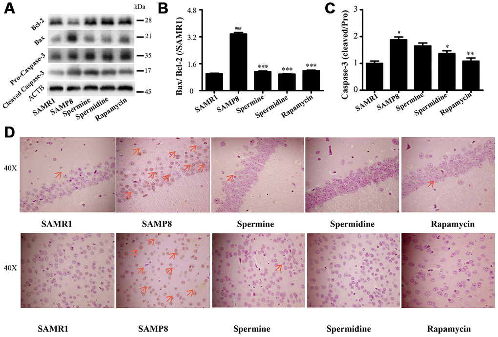 Spermidine and spermine depress apoptosis in SAMP8. (A) The western blot of apoptotic protein. (B) The expression of Bax and Bcl-2 in the brain. (C) The expression of Caspase-3 in the brain. (D) TUNEL staining in cortex. Scale bar: 50μm. Data represent mean ± SEM (n = 3 per group). #P ##P ###P P P P 