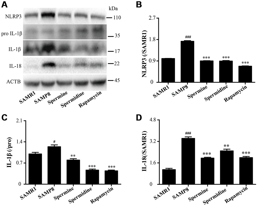 Spermidine and spermine ameliorate inflammation in SAMP8. (A) The western blot of inflammatory protein. (B) The expression of NLRP3 in the brain. (C) The expression of IL-1β in the brain. (D) The expression of IL-18 in the brain. Data represent mean ± SEM (n = 3 per group). #P ##P ###P P P P 