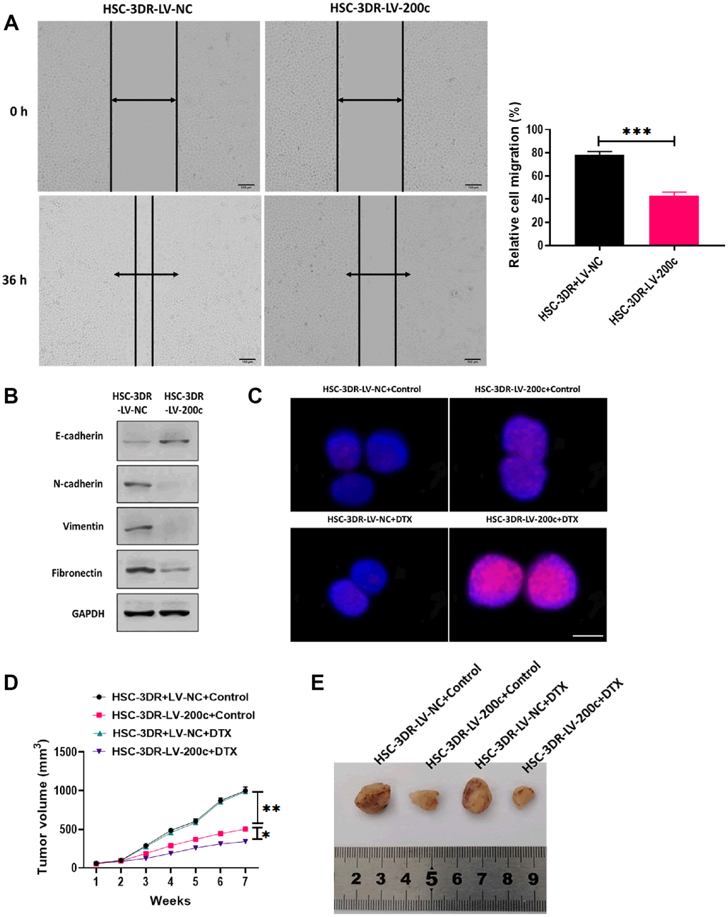 Effect of miR-200c on docetaxel resistance in in vitro and in vivo. (A) Migration ability of HSC-3DR cells treated with miR-200c-encoding lentiviral vectors (LV-200c) was determined by wound healing assays (scale bars = 100 μm). (B) The expressions of EMT-associated proteins in HSC-3DR cells treated with miR-200c-encoding lentiviral vectors (LV-200c) were determined by western blots. (C) The expression of nuclear γ-H2AX in HSC-3DR cells treated with miR-200c-encoding lentiviral vectors (LV-200c) was determined by fluorescence assays (scale bars = 10 μm). (D) Tumor volume of xenograft mice treated with HSC-3DR cells treated with miR-200c-encoding lentiviral vectors (LV-200c) and DTX. (E) Representative images of tumors. Data are presented as mean ± SD. *P P P 