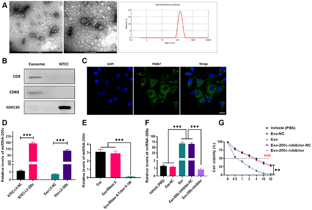 Characteristics and effects of exosomes derived from normal tongue epithelial cells (NTEC) transfected with miR-200c. (A) The morphology and size distribution of exosomes were determined by electron microscopy and nanoparticle tracking analysis (left figure: scale bars = 200 μm and middle figure: scale bars = 100 μm). (B) The expressions of exosome markers were determined by western blots. (C) The internalization of exosomes was determined by fluorescence assays. Blue: nuclei labeled with DAPI. Green: miR-200c-carrying exosomes labeled with PKH67. (D) The expression of miR-200c was determined by qRT-PCR in NTEC transfected with miR-200c-encoding lentiviral vectors (LV-200c) and their exosomes. (E) The expression of miR-200c was determined by qRT-PCR in exosomes treated with RNase A or the combination of RNase A and Triton X-100. (F) The expression of miR-200c was determined by qRT-PCR in HSC-3DR cells treated with miR-200c-carrying exosomes or miR-200c-carrying exosomes with the miR-200c inhibitor. (G) Cell viability was determined by CCK8 assays in HSC-3DR cells treated with miR-200c-carrying exosomes or miR-200c-carrying exosomes with the miR-200c inhibitor. Data are presented as mean ± SD. *P P P 