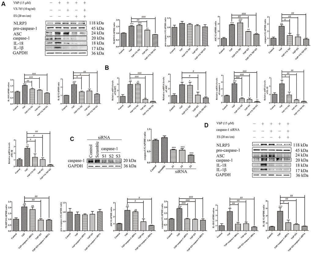 ES inhibits caspase-1-dependent pyroptosis of THP-1 macrophage induced by vbp. (A) Western blot analysis of the effect of caspase-1 inhibition on pyroptosis-related proteins. (B) RT-qPCR analysis of the effect of caspase-1 inhibition on pyroptosis-related mRNAs. (C) Representative western blot results showing downregulation of caspase-1 expression following siRNA-mediated caspase-1 knockdown. (D) Western blot analysis of the effect of caspase-1 knockdown on pyroptosis-related proteins. n = 3; *P#P##P###P