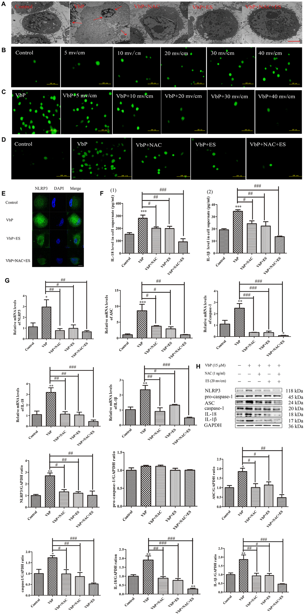 ES inhibits ROS production in VbP-treated THP-1 macrophages. (A) TEM analysis of ultrastructural alterations in THP-1 macrophages. Red arrows indicate cell swelling and nuclear pyknosis (scale bar: 10 μm). (B) DCFH-DA staining showing ROS generation in control macrophages following ES at different voltages (scale bar: 100 μm). (C) DCFH-DA staining showing ROS generation in VbP-treated macrophages following ES at various voltages (scale bar: 100 μm). (D) DCFH-DA staining showing ROS generation in VbP-treated macrophages exposed to NAC and ES (scale bar: 100 μm). (E) Effect of ES, alone or combined with NAC, on NLRP3 immunofluorescence in VbP-treated macrophages (scale bar: 20 μm). (F) ELISA analysis of the effects of NAC and ES on (1) IL-18 and (2) IL-1β secretion by THP-1 macrophages. (G) RT-qPCR analysis of the effects of NAC and ES on pyroptosis-related mRNAs. (H) Western blot analysis of the effects of NAC and ES on pyroptosis-related proteins. n =3; *P#P##P###P