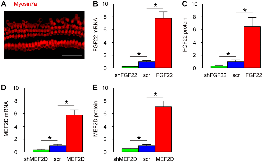 Modulation of FGF22 and MEF2D levels in the cultured mouse hair cells. (A) Isolated mouse hair cells in culture and immunostained with Myosin7a (in red). (B, C) Cultured hair cells were transduced with AAV-FGF22 or AAV-shFGF22 or control AAV-scr (scramble) and assessed for FGF22 levels by RT-qPCR (B), and by ELISA (C). (D, E) Cultured hair cells were transduced with AAV-MEF2D or AAV-shMEF2D or control AAV-scr (scramble) and assessed for MEF2D levels by RT-qPCR (D), and by ELISA (E). *p