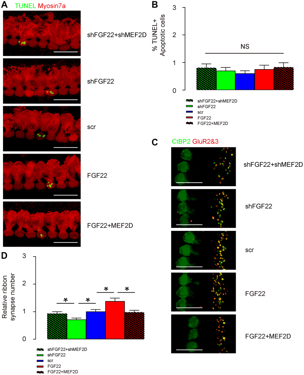 FGF22 depletion reduces ribbon synapse number in vivo. AAV-shFGF22 and AAV-FGF22 were administrated to mouse cochlea to deplete or overexpress FGF22 in hair cells, respectively. Co-administration of AAV-shMEF2D with AAV-shFGF22 was also performed to assess the regulatory relationship between FGF22 and MEF2D in hair cells and ribbon synapses. Similarly, co-administration of AAV-MEF2D with AAV-FGF22 was performed, also to assess the regulatory relationship between FGF22 and MEF2D in hair cells and ribbon synapses. (A, B) TUNEL staining was performed on cochlea, showing by representative images (A), and by quantification (B). (C, D) The ribbon synapses were determined by co-staining for CtBP2 (in green) and GluR2&3 (in red). Cochlear ribbon synapse number was assessed, shown by representative images (C), and by quantification (D). *p