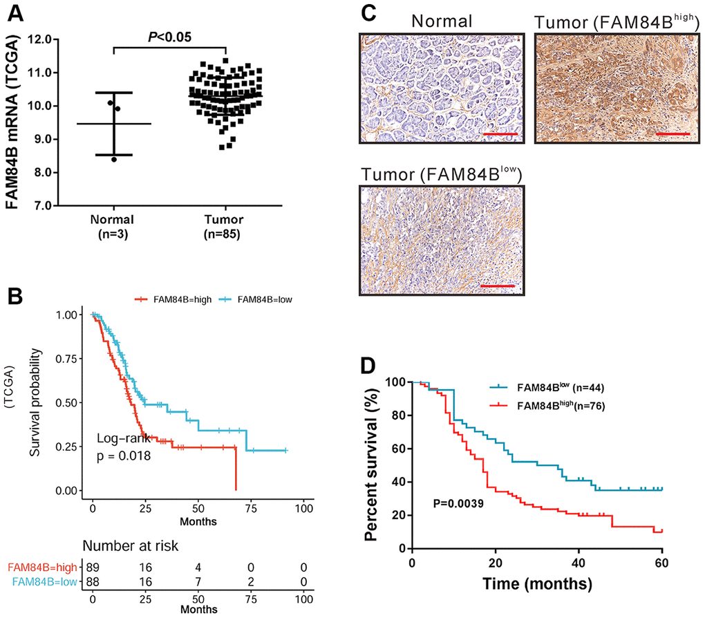 FAM84B expression in PDAC. (A) mRNA expression analysis of FAM84B in TCGA PDAC dataset. (B) Survival analysis of FAM84B in TCGA PDAC dataset. High FAM84B expression indicated worse prognosis. (C) IHC analysis of FAM84B expression in PDAC tissues and adjacent normal tissues (magnification scale bar, 100 μm) from cohort 2 patients. (D) Survival analysis of PDAC based on IHC analysis.