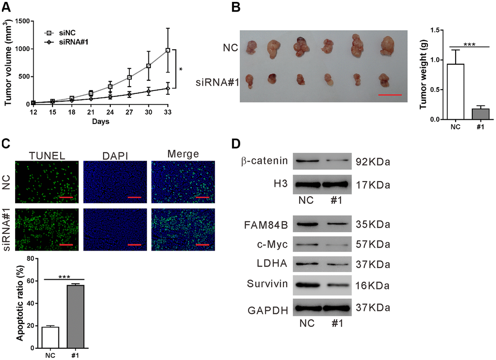 Effect of FAM84B knockdown on tumor progression in vivo. Nude mice were transplanted with AsPC-1 cells stably expressing control siRNA (NC) or FAM84B siRNA (siRNA#1). (A) Tumor volume were recorded for 33 days. (B) At 33 days post transplantation, xenografts were collected, photographed and weighed. Scale bar: 2 cm. (C) TUNEL assay was performed to assess apoptotic rate in the collected xenografts (magnification scale bar, 100 μm). (D) Nuclear β-catenin and the protein levels of c-Myc, LDHA and Survivin were detected. *P 