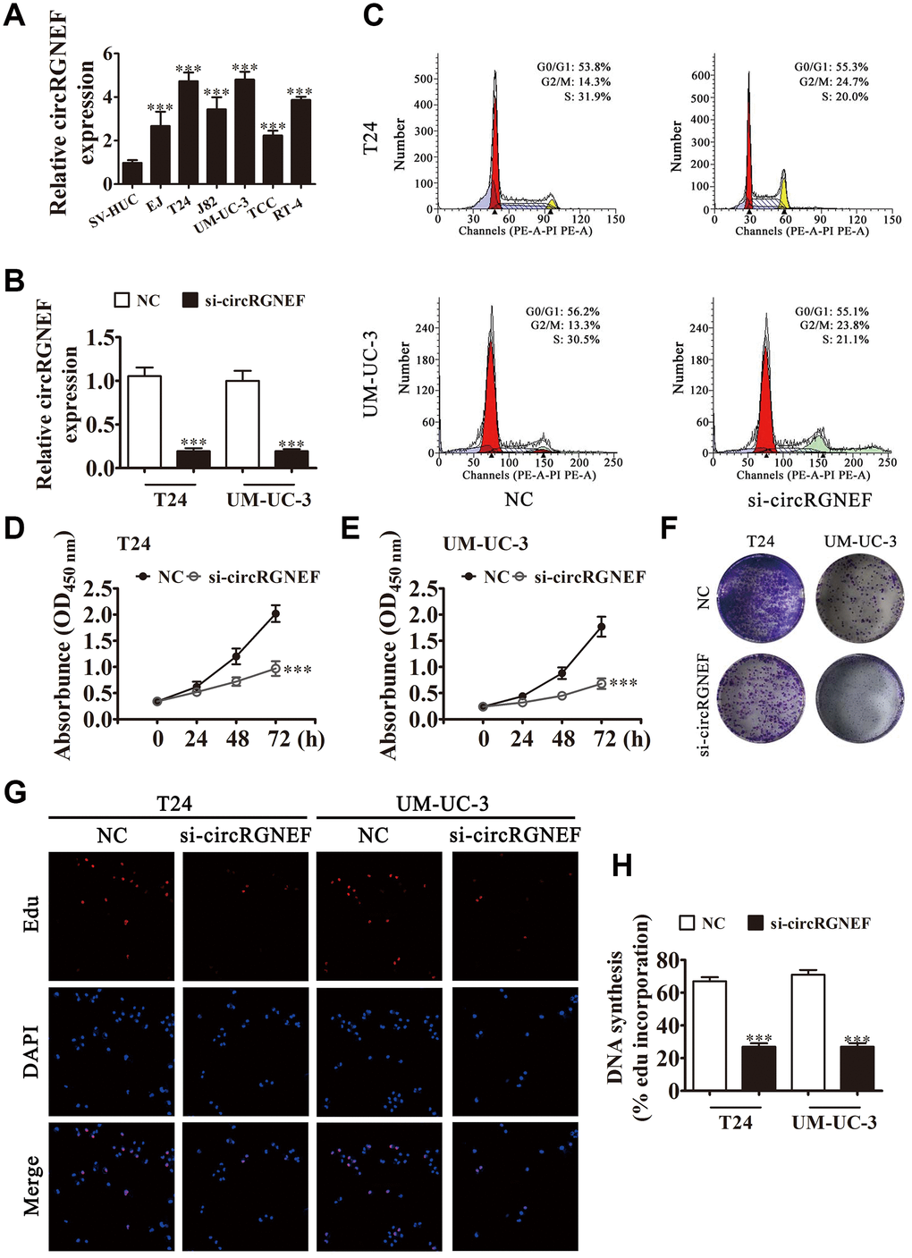 circRGNEF expression was also increased in BC cell lines and knockdown of circRGNEF suppressed cell proliferation. (A) RT-qPCR detection of circRGNEF expression in BC cell lines EJ, T24, J82, UM-UC-3, TCC, and RT-4, and the normal cell line SV-HUC. Data are presented as the mean ± SD. ***P B) RT-qPCR detection shows the expression of circRGNEF in both T24 and UM-UC-3 cells following transfection with small interfering RNA targeting circRGNEF (si-circRGNEF) or negative control (NC). Data are presented as the mean ± SD. ***P C) Cell cycle distribution by flow cytometry after propidium iodide staining. (D, E) CCK8 assay shows the proliferation of T24 and UM-UC-3 cells with or without circRGNEF silencing. Data are presented as the mean ± SD. ***P F) Colony formation assay was performed to determine the colony-forming ability of T24 and UM-UC-3 cells. (G, H) circNRIP1 silencing significantly inhibited DNA synthesis, as determined by the EdU assay. Data are presented as the mean ± SD. ***P 