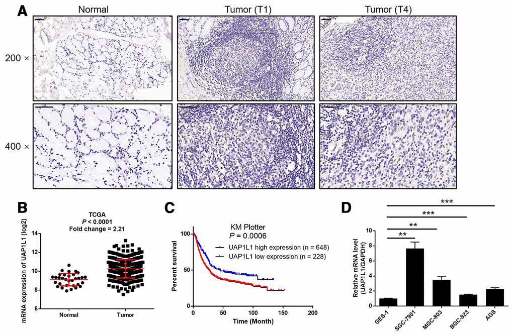 UAP1L1 was upregulated in gastric cancer tissues and gastric cancer cells. (A) The expression level of UAP1L1 was detected by IHC analysis in gastric cancer tissues and normal tissues (scale bar = 50 μm). (B) The mining of RNA-seq data of TCGA showed the upregulated mRNA expression of UAP1L1 in tumor tissues of gastric cancer patients compared with that in normal tissues. (C) The mining of prognosis data of KM plotter showed the significantly association between UAP1L1 high expression and shorter survival period of gastric cancer patients. (D) The mRNA expression of UAP1L1 in GES-1, BGC-823, SGC-7901, AGS and MGC-803 cell lines was detected by qPCR. The representative images were selected from at least 3 independent experiments. Data was shown as mean ± SD. *P P P 