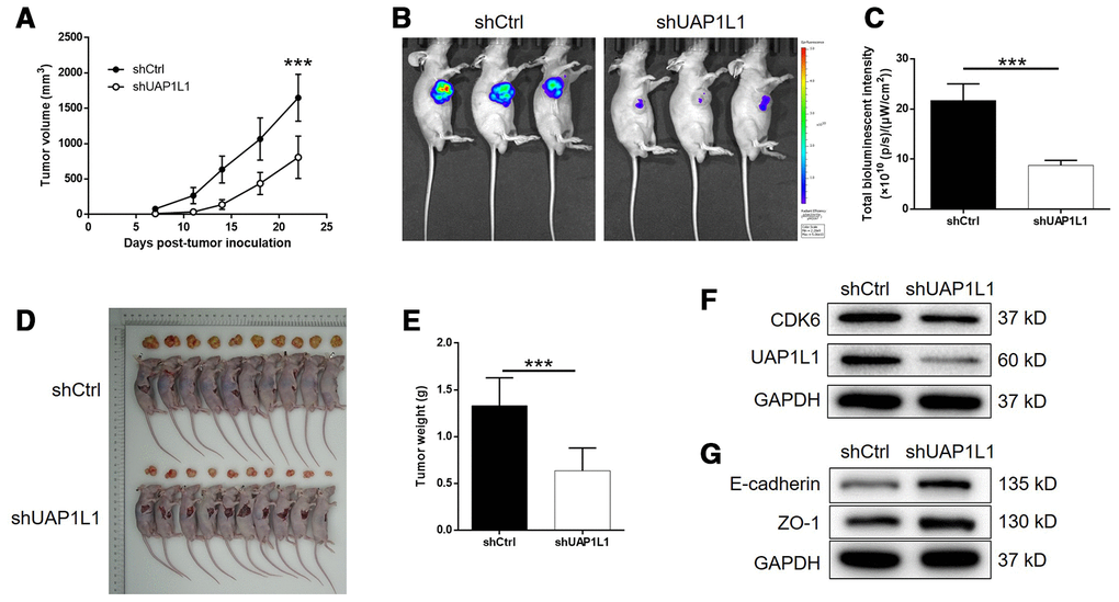 UAP1L1 knockdown inhibited gastric cancer development in vivo. (A) 7 days post injection of SGC-7901 cells with or without UAP1L1 knockdown, the volume of tumors formed in mice was measured and calculated at indicated time intervals. (B) In vivo imaging was performed to evaluate the tumor burden in mice of shUAP1L1 and shCtrl groups at day 22 post tumor-inoculation. (C) The bioluminescence intensity was scanned and used as a representation of tumor burden in mice of shUAP1L1 and shCtrl groups. (D, E) Mice were sacrificed at day 22 post injection, and the tumors were removed for collecting photos (D) and weighing (E). (F, G) The expression of UAP1L1, CDK6, E-cadherin and ZO-1 in xenografts was detected by western blotting. Data was shown as mean ± SD. *P P P 