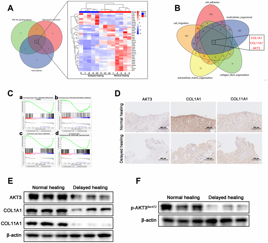 Downregulation of AKT3, COL1A1, and COL11A1 in delayed cutaneous wound tissue. (A) Venn diagram of the KEGG pathway. (a) Venn analysis identified 35 genes that were enriched in PI3K-AKT signaling, ECM-receptor interactions, and focal adhesion. (b) The heatmap expression profile of the 35 changed genes. (B) Venn diagram of GO analysis for the tissue remodeling-associated biological functions. AKT3, COL1A1, and COL11A1 were enriched. (Ca–d) Gene set enrichment analysis (GSEA) of cutaneous wound tissue. The genes associated with (a) cell adhesion molecules, (b) collagen metabolic processes, (c) focal adhesion, and (d) extracellular structural organization were negatively enriched in the delayed cutaneous wound tissue. (D) IHC staining of AKT3, COL1A1, and COL11A1 in cutaneous wound tissue (200 x). The levels of all three proteins were reduced in the delayed wound tissue. (E) Decreased AKT3, COL1A1, and COL11A1 protein levels in delayed cutaneous wound tissue. (F) Total AKT3 and phosphorylated-Ser472 AKT3 levels were decreased in delayed cutaneous wound tissue. All the experiments were repeated at least three times.