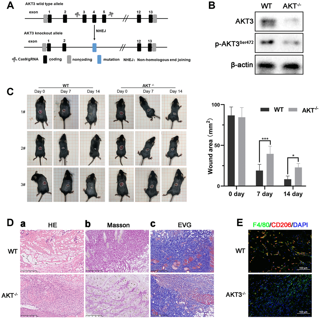 Loss of AKT3 delayed cutaneous wound healing in mice. (A) Schematic of AKT3 knockout in mice. (B) Western blotting for AKT3 levels in AKT3+/+ and AKT3-/- mice (n = 6). (C) AKT3 knockout delayed cutaneous wound healing in mice by days 7 and 14 post-injury. (Da–c) Histological staining of mouse cutaneous wound tissue. (a) H&E staining showed more inflammatory cells in the wound tissue of AKT3-/- mice and incomplete tissue integrity (n = 6). (b) Masson staining showed the numbers of collagenous and muscular fibers were reduced in the wound tissue of AKT3-/- mice (n = 6). (c) EVG staining showed that number of elastin fibers were decreased in the wound tissue of AKT3-/- mice (n = 6). (E) IF staining showed the F40/80 and CD206 expression in mouse cutaneous wound tissue. All the experiments were repeated at least three times.