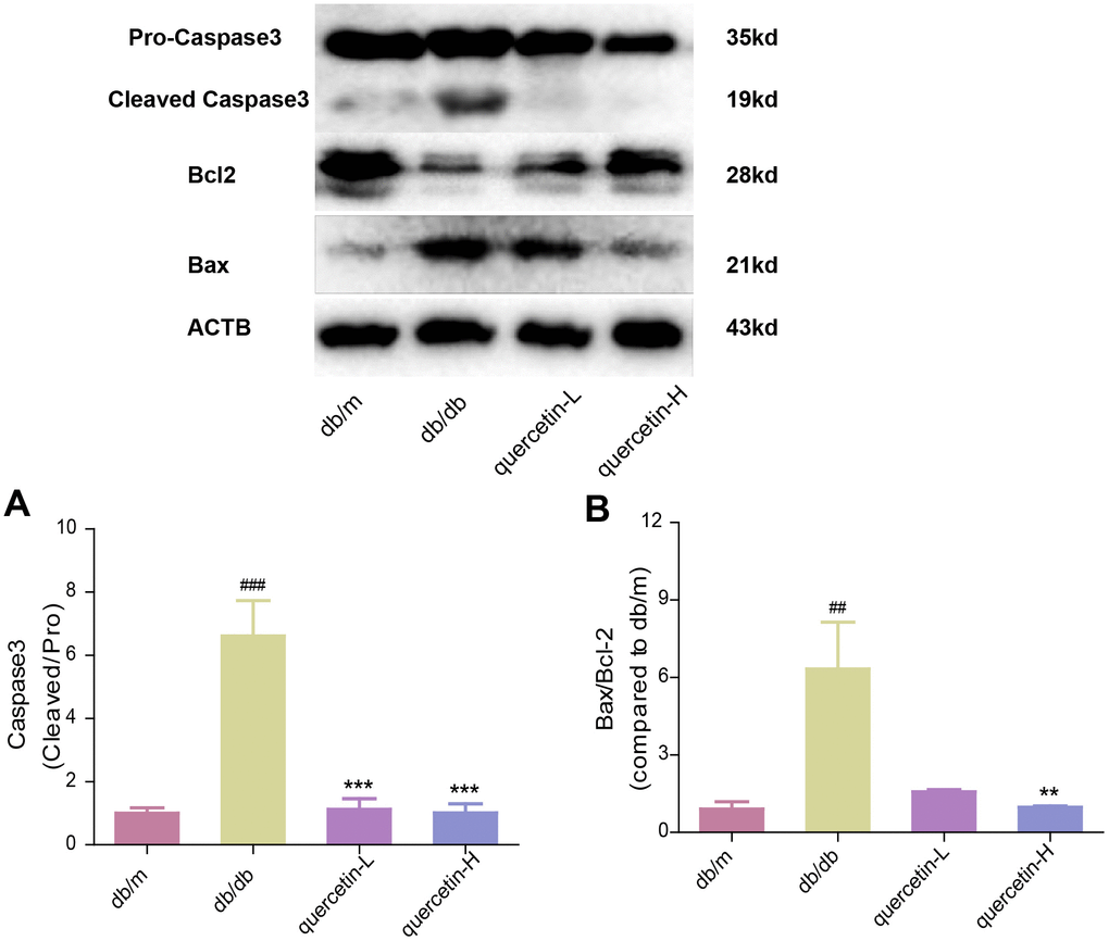 Quercetin protects against neuronal apoptosis in the brain of db/db mice. Western blot analysis: (A) Caspase3; (B) Bax/Bcl2. Quercetin-L: 35mg/kg/d; Quercetin-H: 70mg/kg/d. Data represent mean ± SEM (n = 10 per group). #p p p p p p 