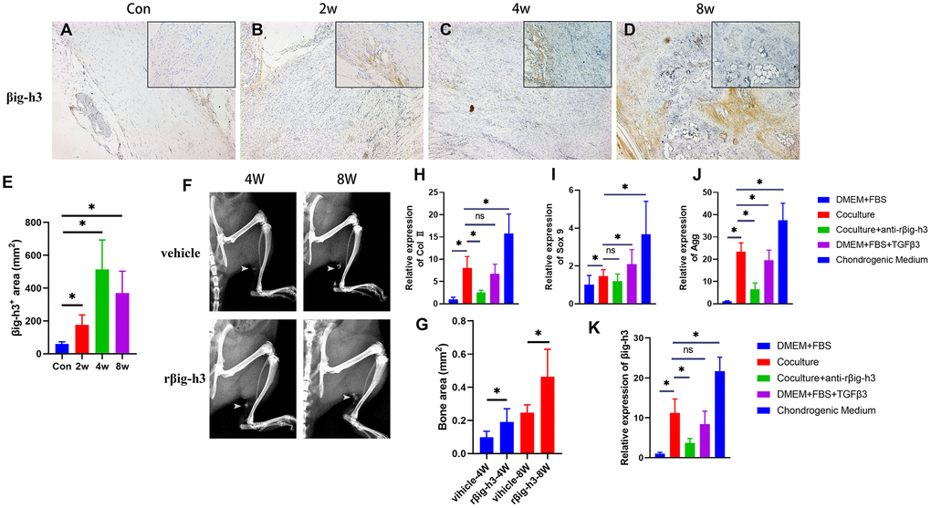 βig-h3 is involved in chondrogenic differentiation for HO formation. (A–E) The immunohistological staining of βig-h3+ cells (brown). (F, G) The represent X ray and statistics of rat with/without rβig-h3 injection. (H–J) The expression of Sox 9, Aggrecan, and Col II with/without coculture of macrophage cells. (K) The expression of βig-h3 with/without coculture of macrophage cells. *p 