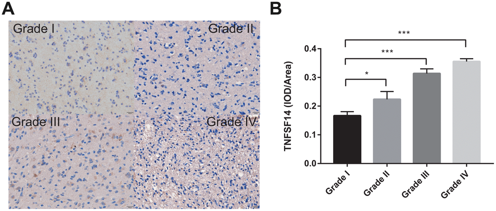 Levels of TNFSF14 expression relative to common pathology in glioma tissue. (A) Levels of expression and representative photographs of immunohistochemical staining of TNFSF14 in different grades of gliomas. (B) Quantitative bar graphs of immunohistochemical staining in each grade.