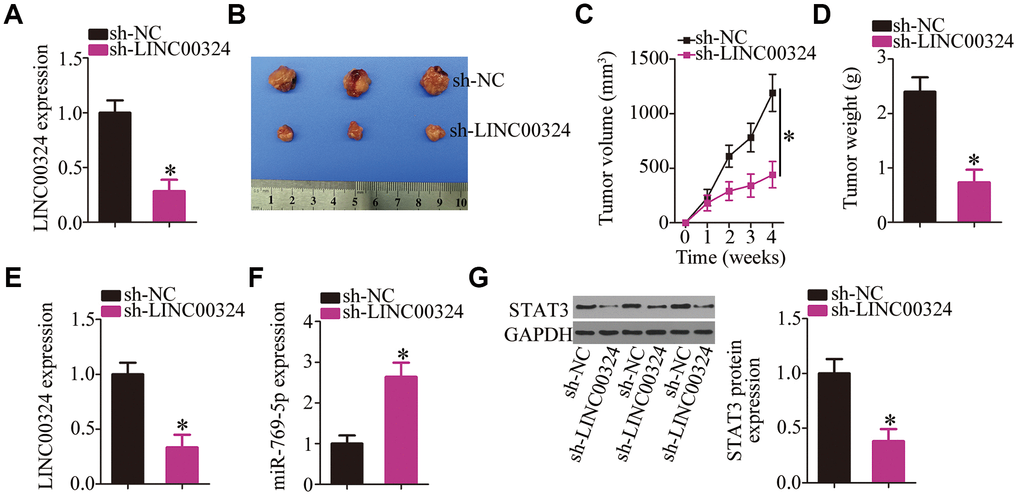 Depletion of LINC00324 attenuates the tumor growth of RB cells in vivo. (A) RT-qPCR analysis was utilized to assess the efficiency of sh-LINC00324 in Y79 cells. *P B) The tumor growth rate was significantly suppressed by sh-LINC00324, as compared with that of the sh-NC group. *P C) At the conclusion of the assay, the mice were euthanized, and the tumor xenografts were excised. Representative images of tumor xenografts from the sh-LINC00324 and sh-NC groups. (D) The average weight of the tumor xenografts was determined in the sh-LINC00324 and sh-NC groups. *P E, F) RT-qPCR was carried out to analyze the expression of LINC00324 and miR-769-5p in the tumor xenografts. *P G) Total protein was isolated from tumor xenografts, and then subjected to western blotting to measure STAT3 protein expression. *P 