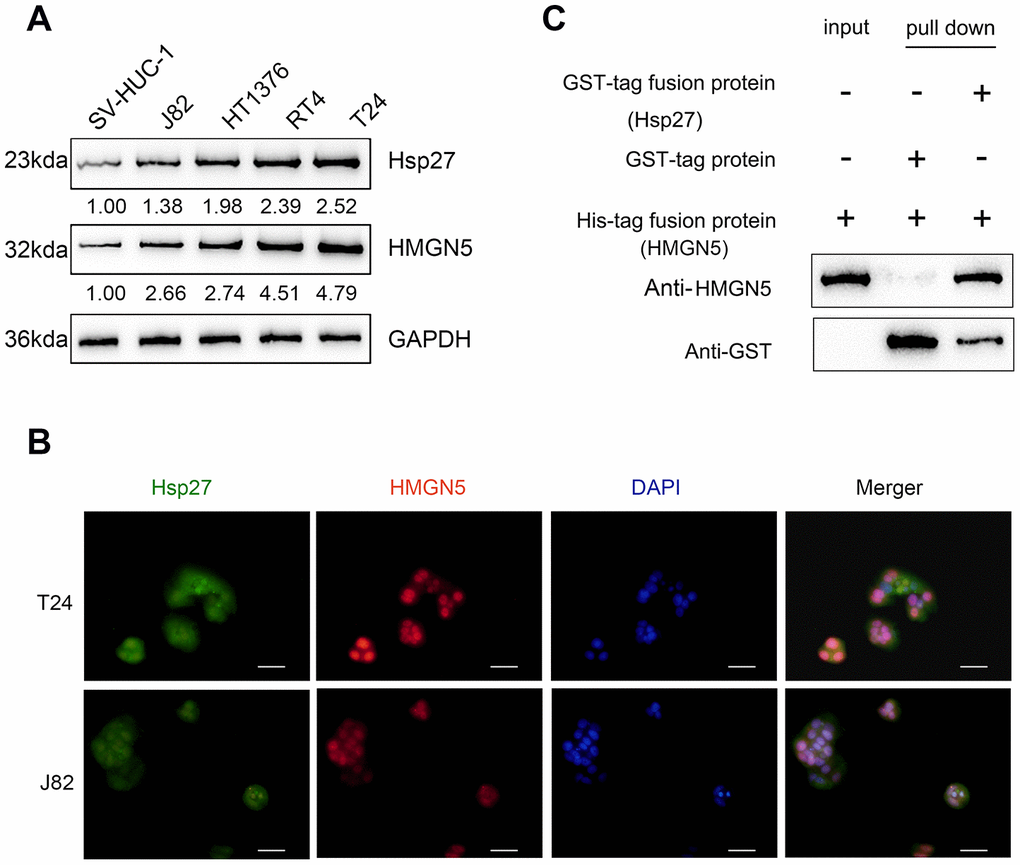 HMGN5 interacts with Hsp27 in vivo and in vitro. (A) The protein levels of Hsp27 and HMGN5 in bladder cancer cell lines examined by immunoblotting. (B) The protein levels and localization of Hsp27 and HMGN5 in T24 and J82 cells examined by IF staining. (C) In vitro GST pull-down assays were used to examine the interaction between HMGN5 and Hsp27.