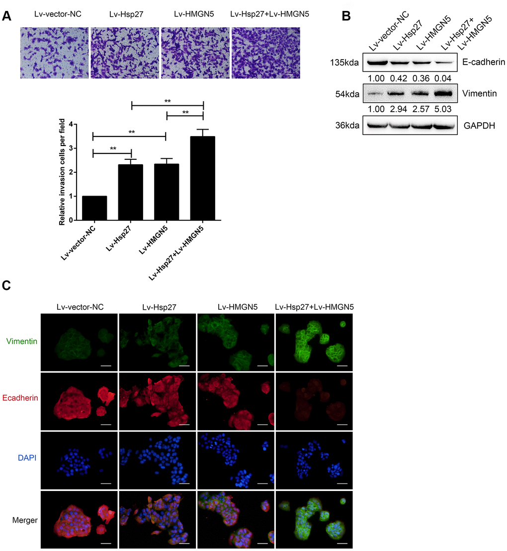 HMGN5 interacts with Hsp27 to modulate bladder cancer cell invasion and EMT. (A) J82 cells were transduced with Lv-HMGN5 or Lv-Hsp27, separately, or cotransduced with Lv-HMGN5 and Lv-Hsp27, and examined for cell invasion by Transwell assays. (B) The protein levels of E-cadherin and Vimentin, as demonstrated by immunoblotting, (C) The protein levels of E-cadherin and Vimentin by IF staining. The data are presented as the mean ± SD of three independent experiments. **P
