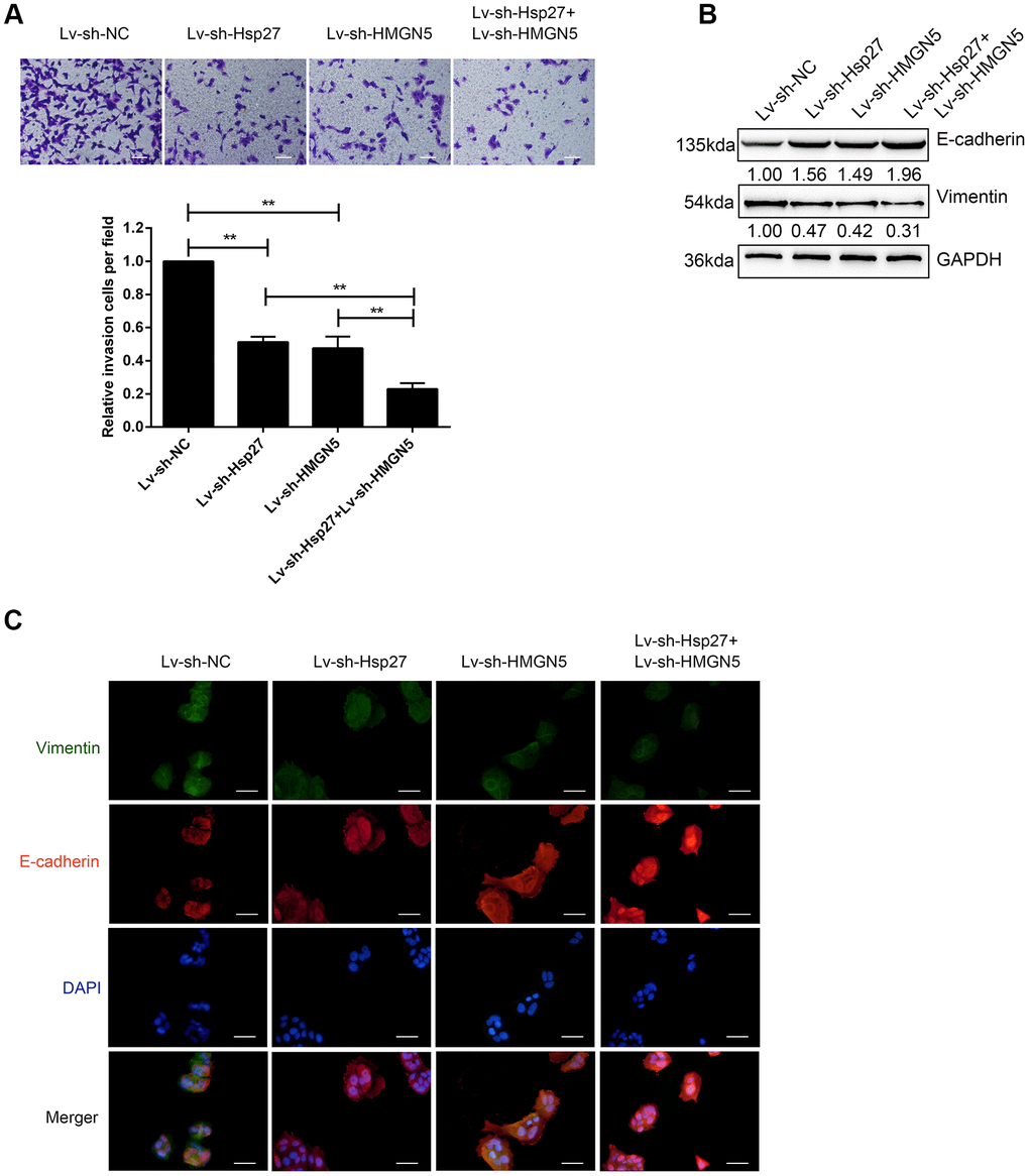 Silencing of HMGN5 and Hsp27 inhibits bladder cancer cell invasion and EMT. (A) T24 cells were transduced with Lv-sh-HMGN5 or Lv-sh-Hsp27, separately, or cotransduced with Lv-sh-HMGN5 and Lv-sh-Hsp27, and examined for cell invasion by Transwell assays. (B) The protein levels of E-cadherin and Vimentin by immunoblotting. (C) The protein levels of E-cadherin and Vimentin by IF staining. The data are presented as the mean ± SD of three independent experiments. **P