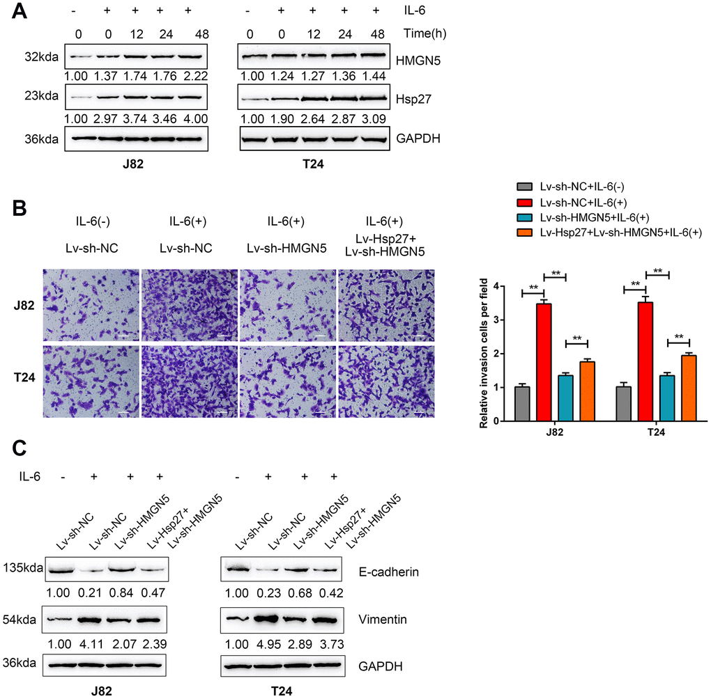 HMGN5 is involved in IL-6-Hsp27-induced cell invasion and EMT in bladder cancer cells. (A) T24 cells were serum starved overnight and treated with 50 ng/mL IL-6 for 0 to 48 h (0, 6, 12, 24, 48 h) and examined for the protein levels of HMGN5 and Hsp27 by immunoblotting. (B) T24 cells were cotransduced with Lv-Hsp27 and Lv-sh-HMGN5, serum starved overnight, treated with 50 ng/mL IL-6 for 24 h and examined for cell invasion by Transwell assays, and (C) the protein levels of E-cadherin and Vimentin were determined by immunoblotting, compared to those in Lv-Vector-transduced cells without IL-6 treatment. The data are presented as the mean ± SD of three independent experiments. **P